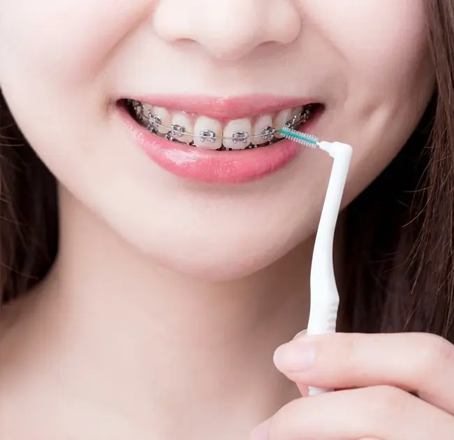 Berus Interdental Mencipta Pengalaman Baharu Penjagaan Mulut Yang Diperhalusi